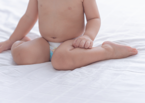 bebeklerde kalça çıkığı