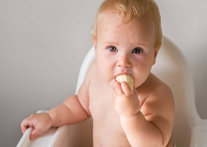 bebeklerde kızamık